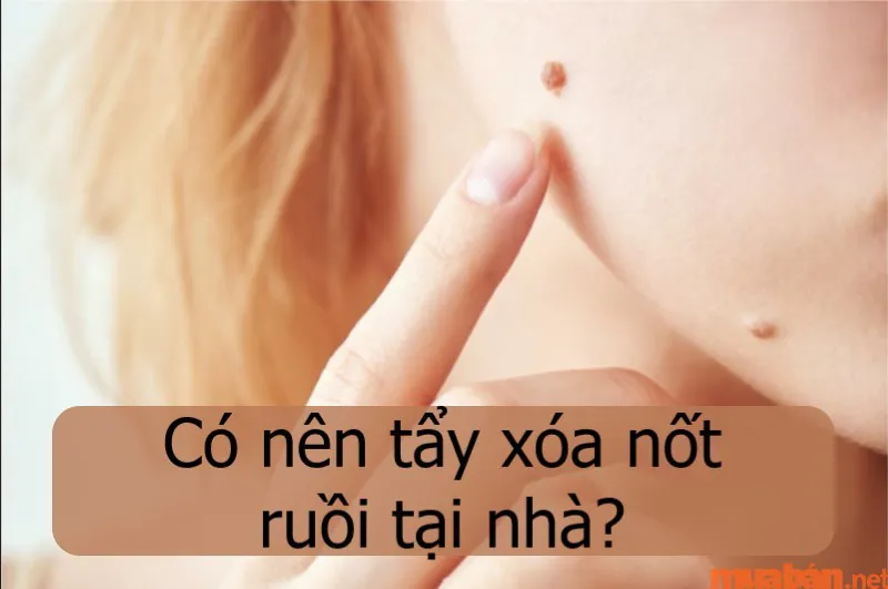 Giải mã nốt ruồi ở xương quai hàm nam và nữ tốt hay xấu?