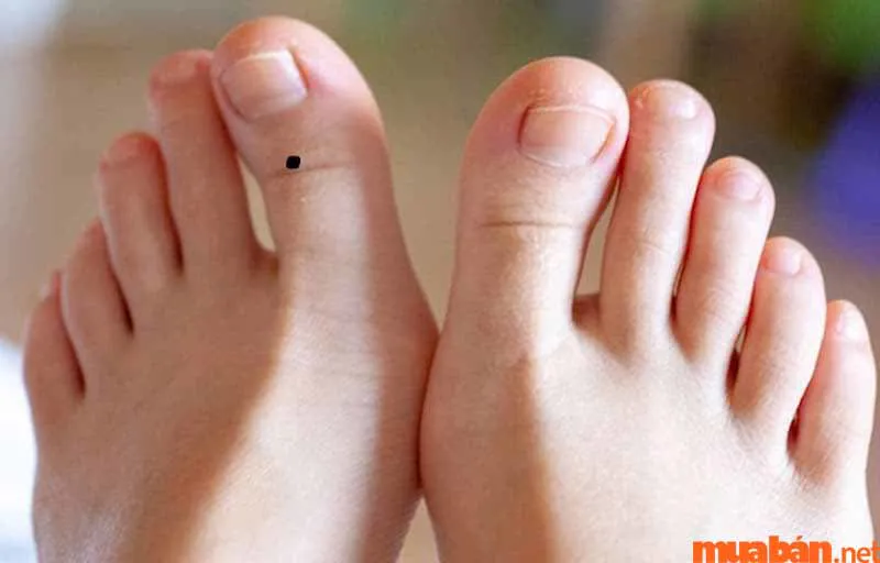 Luận giải ý nghĩa nốt ruồi ở ngón chân cái trong phong thủy